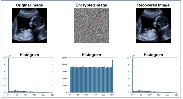 ENCRYPTION OF MEDICAL IMAGES BASED ON TH