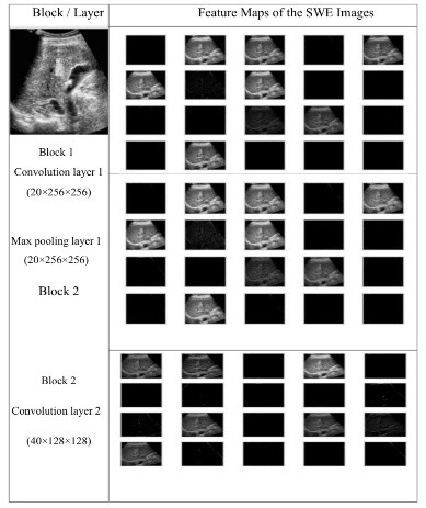Detection of Liver Fibrosis Based on Dee