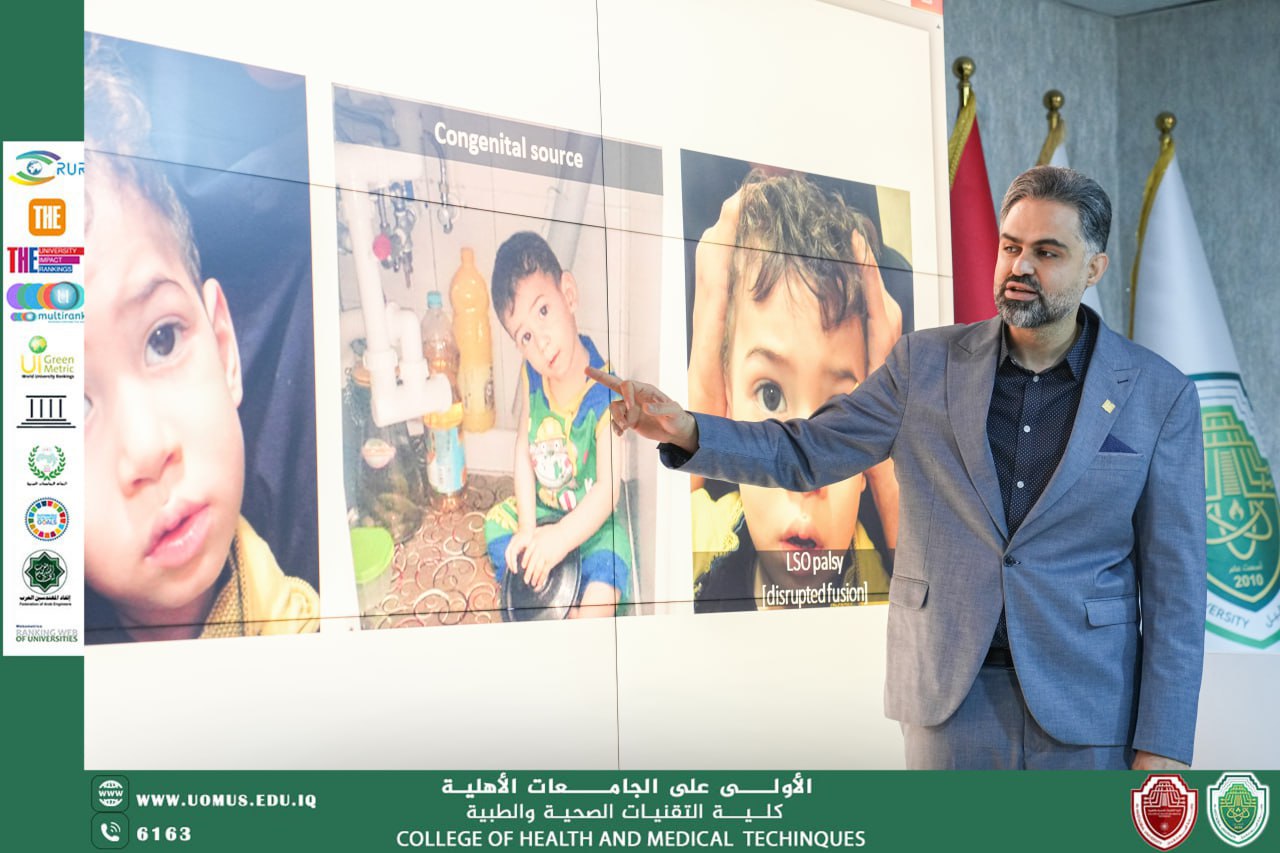 ورشة عمل حول "الحول وعيوب الرؤية الثنائية" وأثرها في تقنيات البصريات