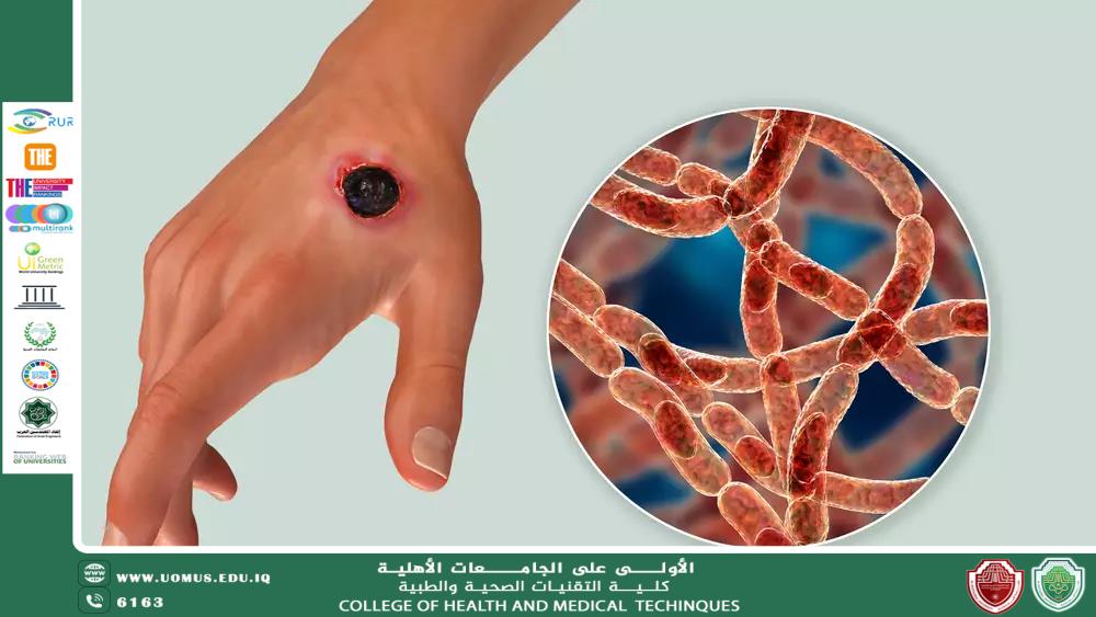 مقالة للاستاذة هدى محمد سليمان بعنوان"مرض‎ ‎الجمرة‎ ‎الخبيثة واعراضة والمسببات والتشخيص وأيضا ‏العلاج‏‎ ‏‏"