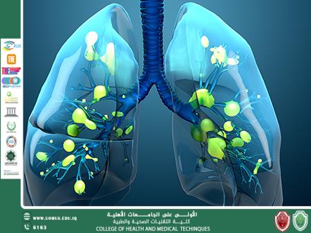 مقالة للاستاذة هدى محمد سليمان بعنوان"متلازمة الصدمة التنفسية الحادة‎ (ARDS)‎ ‏‏"