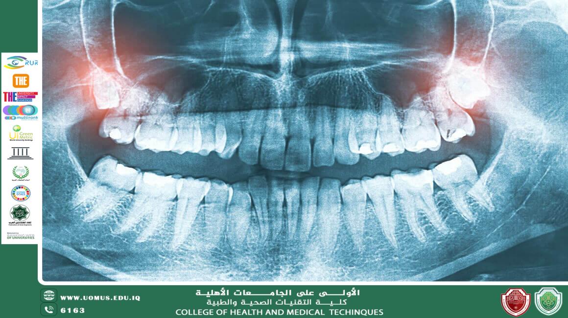 مقالة للاستاذة رفل فاضل خضير بعنوان "أشعة الأسنان: نافذة التشخيص في طب الفم"