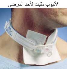 تم نشر مقالة علمية للتدريسي في قسم تقنيات التخدير المدرس المساعد علي فاضل زيدان بعنوان نصائح حول وضع انبوب القصبة الهوائية