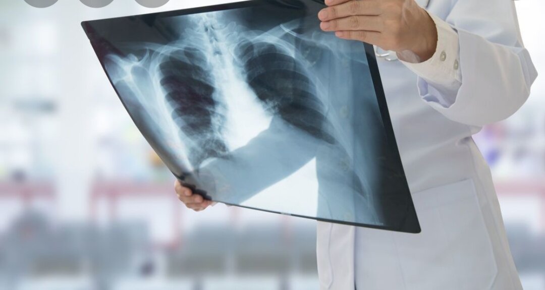 كيمياء   الاشعة السينية (X-rays):          م.ك ايمان  حامد شمخي 