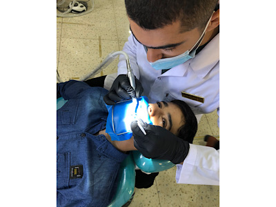 Direct anterior composite