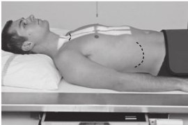 تأثير كعب الأنود في التصوير الشعاعي....م.م حسين علي مدلول 