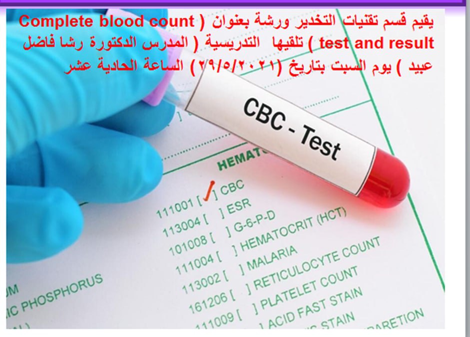 أقام قسم تقنيات التخدير ورشة بعنوان (Complete blood count test and result ) تلقيها  التدريسية ( المدرس الدكتورة رشا فاضل عبيد ) يوم السبت بتاريخ (29/5/2021) الساعة الحادية عشر