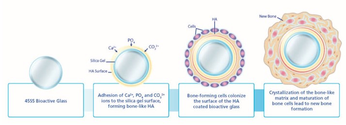 A scientific article for teaching assistant teacher Zainab Jawad Kazem entitled(Bioactive glasses)