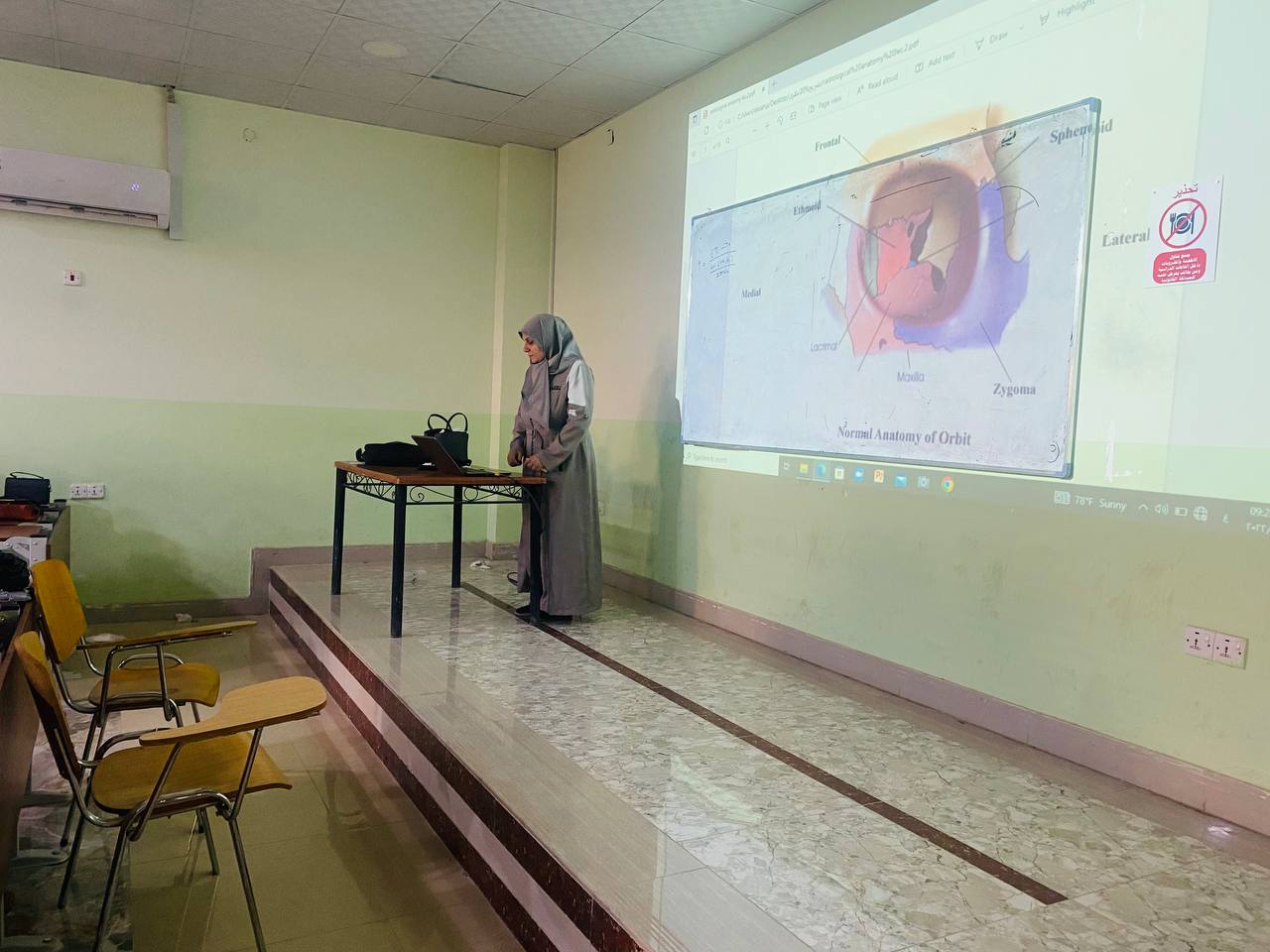 ورشة تعليمية باشراف تدريسية في قسم تقنيات الاشعة د. ضي كاظم بعنوان Anatomy of orbit