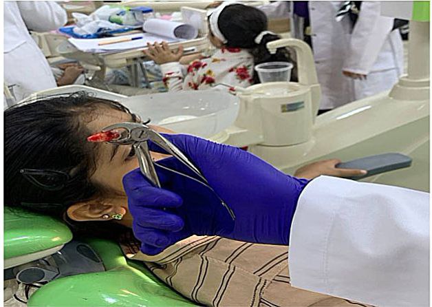 أجراء عملية قلع جراحي لطفلة في عيادة طب اسنان الاطفال 