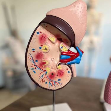 نموذج تشريح الكلى