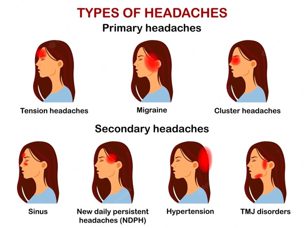 Headache Types