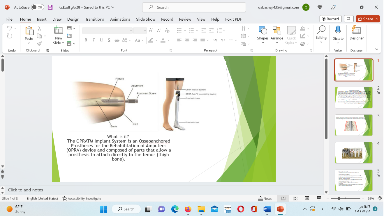 قسم هندسة الطب الحياتي يقيم حملة توعوية عن حالة Osseo-Integration التي تحصل خلال عملية الزرع