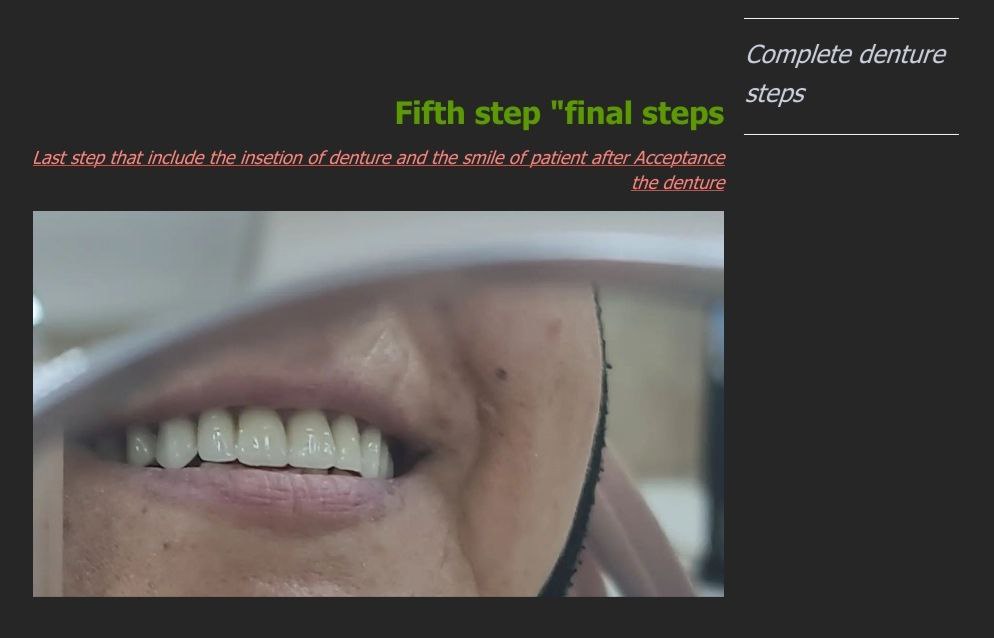 جانب من أبداع الطالبة  مائدة عبد الله في عيادة صناعة الأسنان  