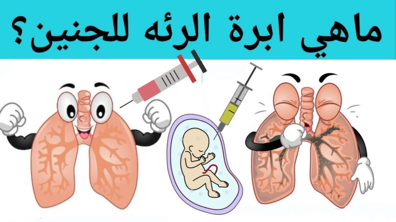 ما هي ابرة اكتمال الرئه للحامل مقالة علمية للست نور فراس محمد رضا