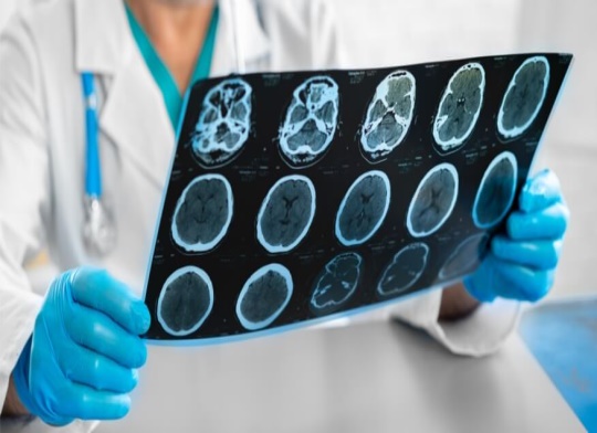 التصوير بالرنين المغناطيسي (MRI) مقالة علمية للتدريسية م.م براء عبد الرضا جواد