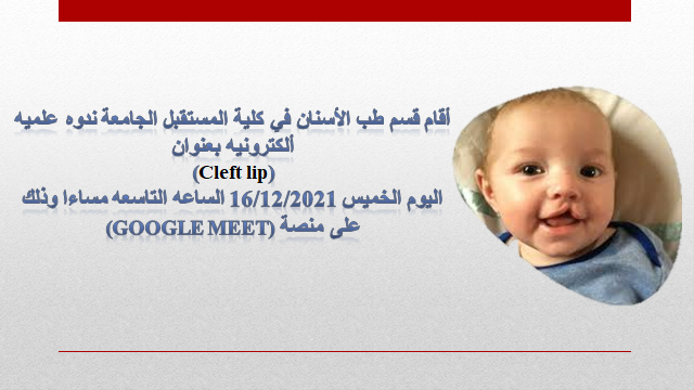 قسم طب الأسنان يقيم ندوه علميه بعنوان (Cleft lip)