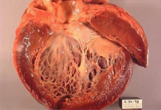 تم نشر مقالة علمية في قسم تقنيات التخدير للتدريسسة( م.م هدى صباح جبر عبد علي) بعنوانKeshan disease and its relationship to Selenium 