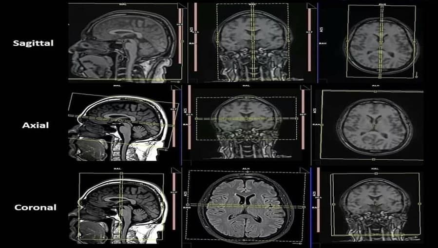 Protocol for Routine MR Imaging of the Brain م.م علي هاني كريم 