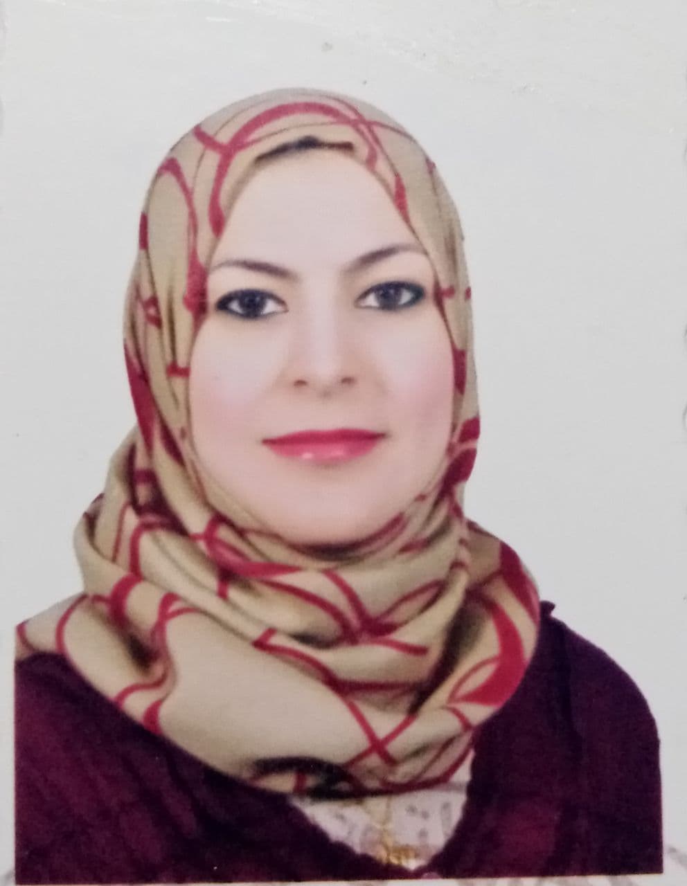 القرنية المخروطية للدكتورة نسمه عدنان جبر 