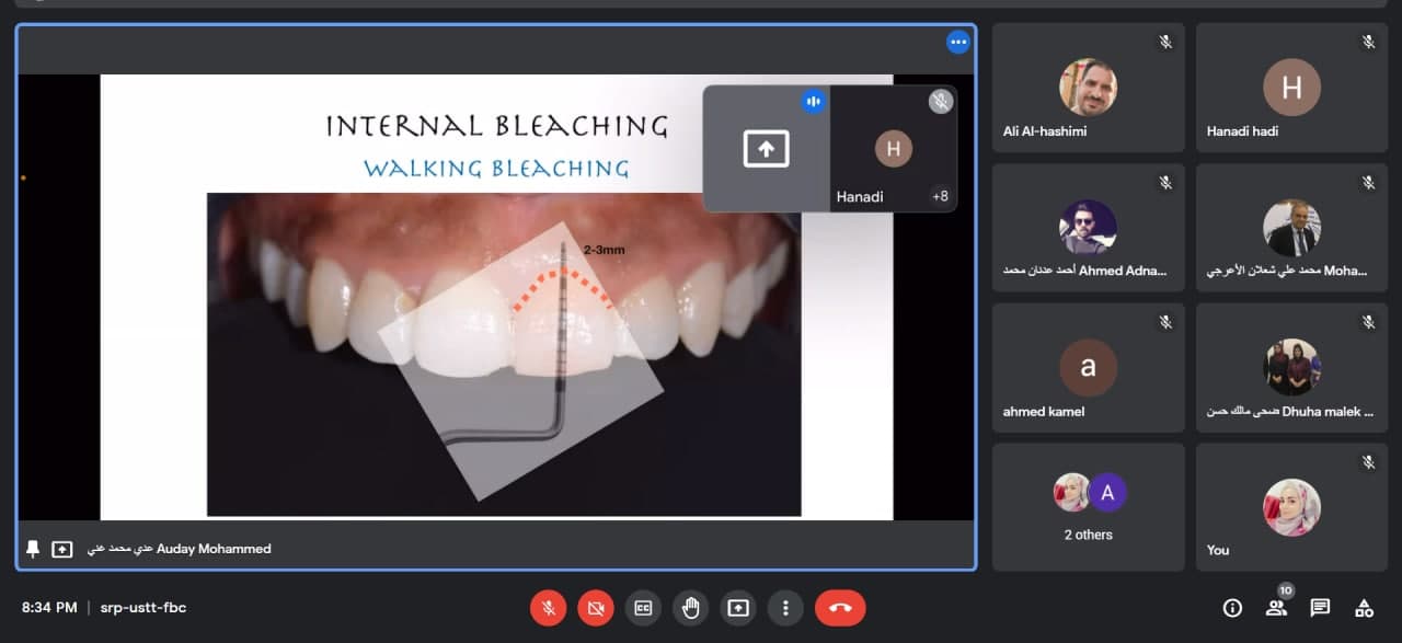 The Department of Dentistry holds an electronic scientific workshop entitled Internal bleaching