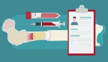 مقالة علمية بعنوان (Top misconceptions about bone marrow donation)