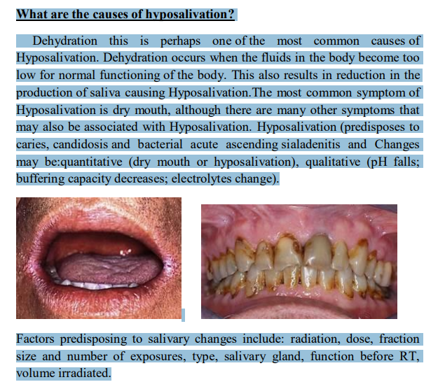 مقالة علمية للدكتورة ضحى مالك حسن بعنوان (What are the causes of hyposalivation )