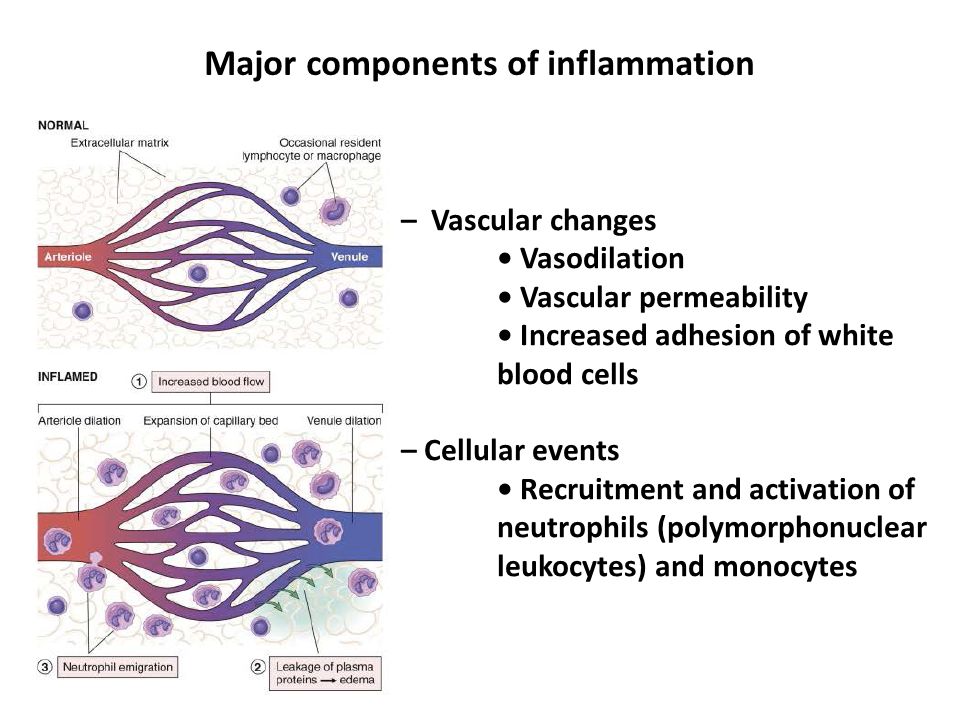 د. اثمارمحمد    Inflammation: