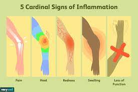 Inflammation   د. اثمار محمد رضا