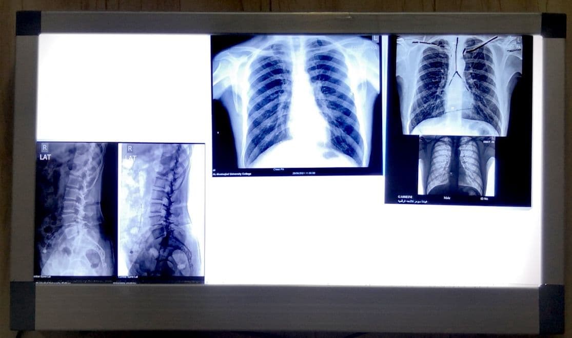 مختبر التصوير الشعاعي والفحوصات الخاصة مرحله ثانيه وثالثه /فيزياوي كرار حيدر