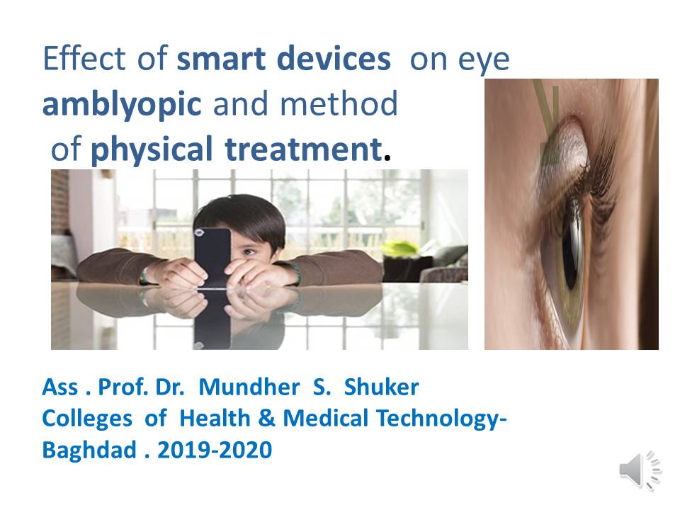 أرشادات حول سلامة العين من قبل الاستاذ المساعد دكتور منذر سمين شكر 