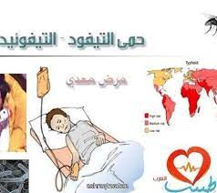 التايفوئيد م.م زهراء سامي محمد