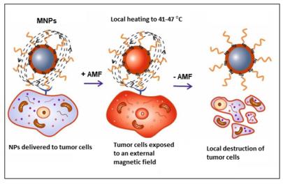 Magnetic Hyperthermia Scientific article By Dr.Mohammed Hashim 