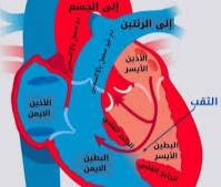 مقاله علميه حول ثقب القلب عند الأطفال للست نور فراس محمد رضا 