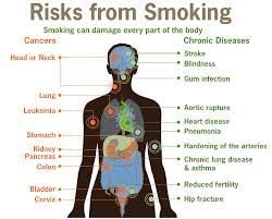 Smoking Risks  Scientific Article By Rusul Nema Kamal