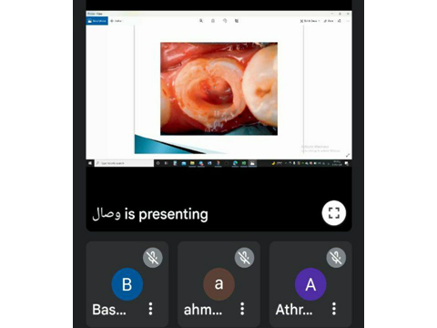 قسم طب الأسنان يقيم محاضرة توعوية عن العلاجات اللبية للأسنان اللبنية والدائميه للأطفال