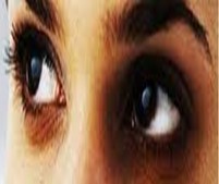 الهالات السوداء