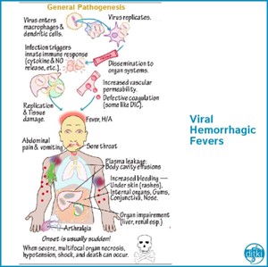 Viral hemorrhagic fever