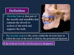 أقامة ندوه علمية ألكترونيه للدكتوره عذراء يحيى محمد الحجازي بعنوان Maxilla, mandible , alveolar bone 