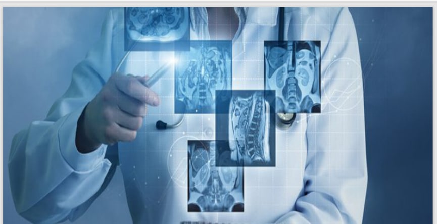 الآثار الصحية المحتملة نتيجة التعرض للإشعاع م.م حسين علي مدلول