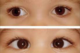 مقاله علمية للتدريسي م.م مروان هشام محمد و المبرمج مصطفى مرتضى خلف بعنوان (حول العين)