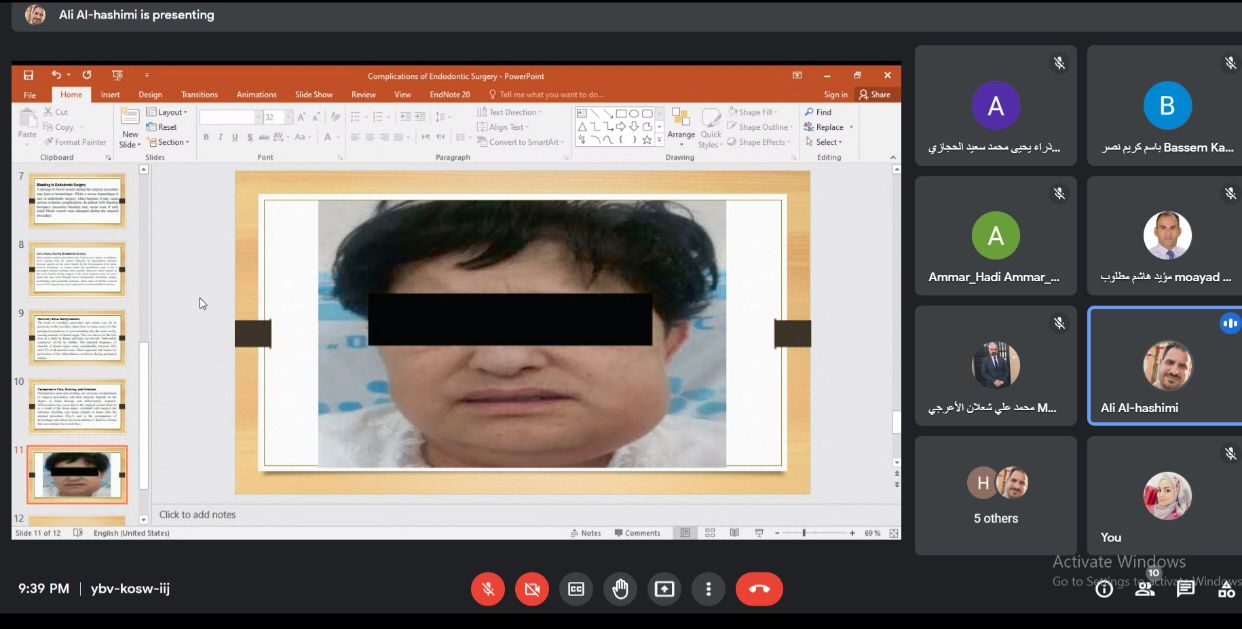 قسم طب الأسنان يقيم محاضرة علمية بعنوان  المشاكل التي تحدث اثناء المعالجه اللبيه الجراحيه للاسنان