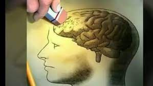 (انفلونزا العقول)