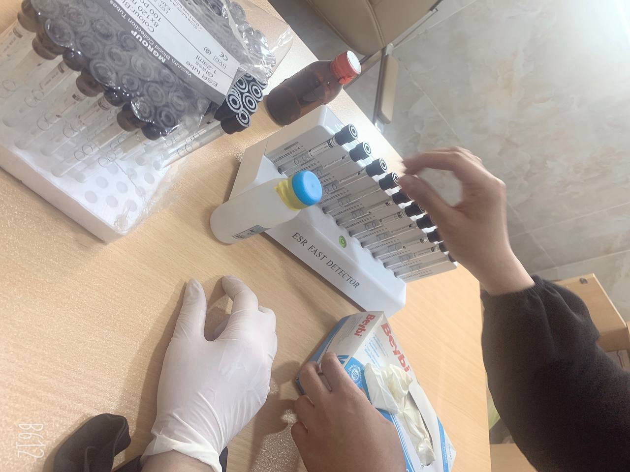 ورشه عمل  كيفيه اجراء اختبار Esr