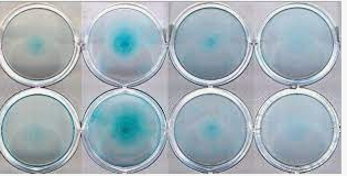 تدريسي في قسم هندسة الطب الحياتي ينظم ندوة علمية  حول تطبيقات تتبع العين في الهندسة الطبية الحيوية