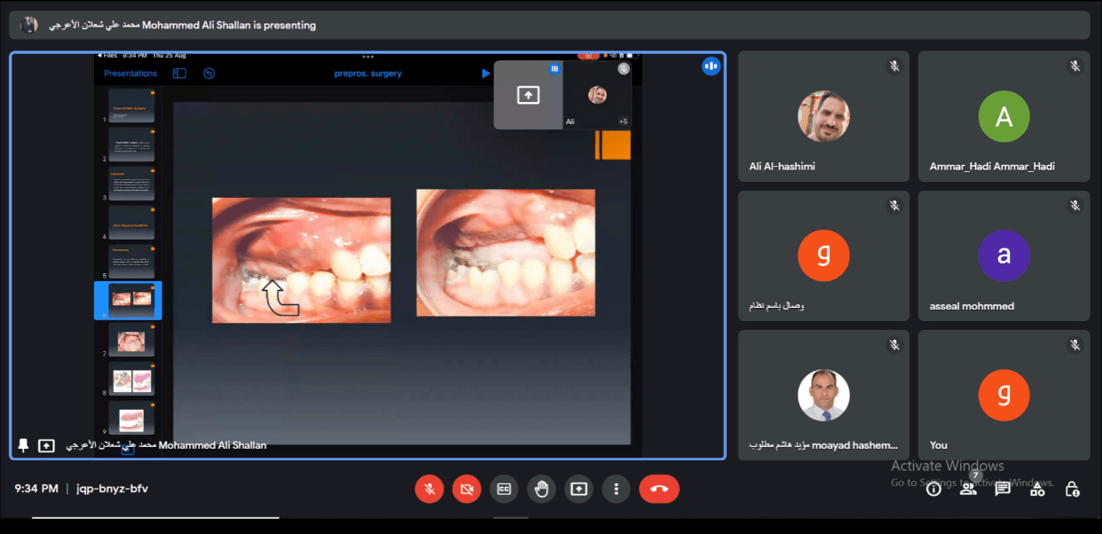 Holding an electronic scientific symposium in the Department of Dentistry entitled "Surgical Orthodontics of the jaws before making prosthetics for the teeth