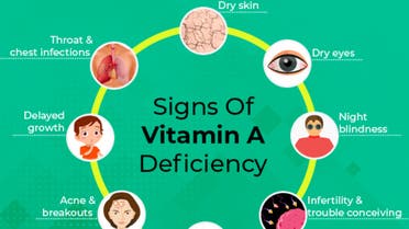 مقالة علمية للتدريسية م.م نور خميس حمد بعنوان (فيتامين (أ) وصحة العين)