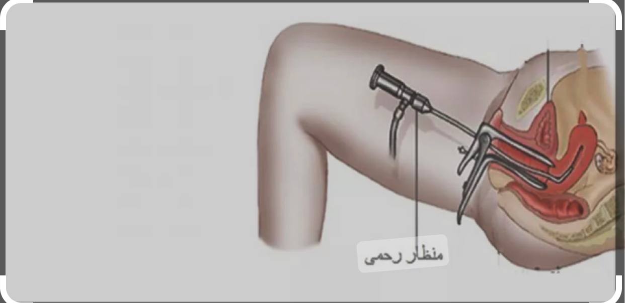 حلقة نقاشية"منظار الرحم التشخيصي (Diagnostic hysteroscopy) "