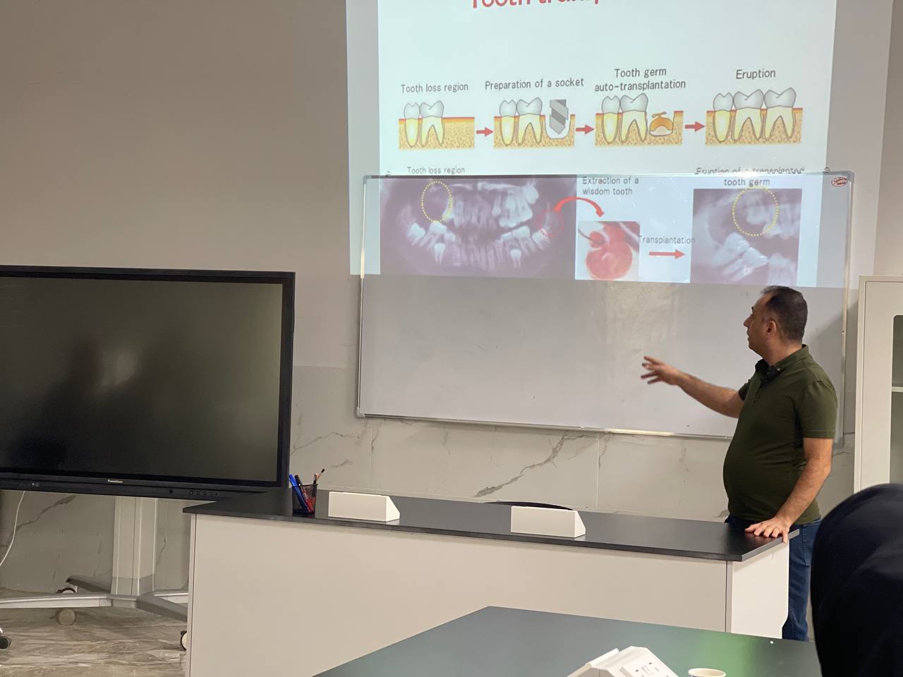 كلية طب الأسنان تقيم ورشة علمية بعنوان tooth transplantation