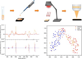 Rapid and sensitive detection of ovarian cancer biomarker using a portable single peak Raman detection method